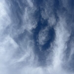 バセドウ病と診断される前と後では過ごし方はどう変わる？